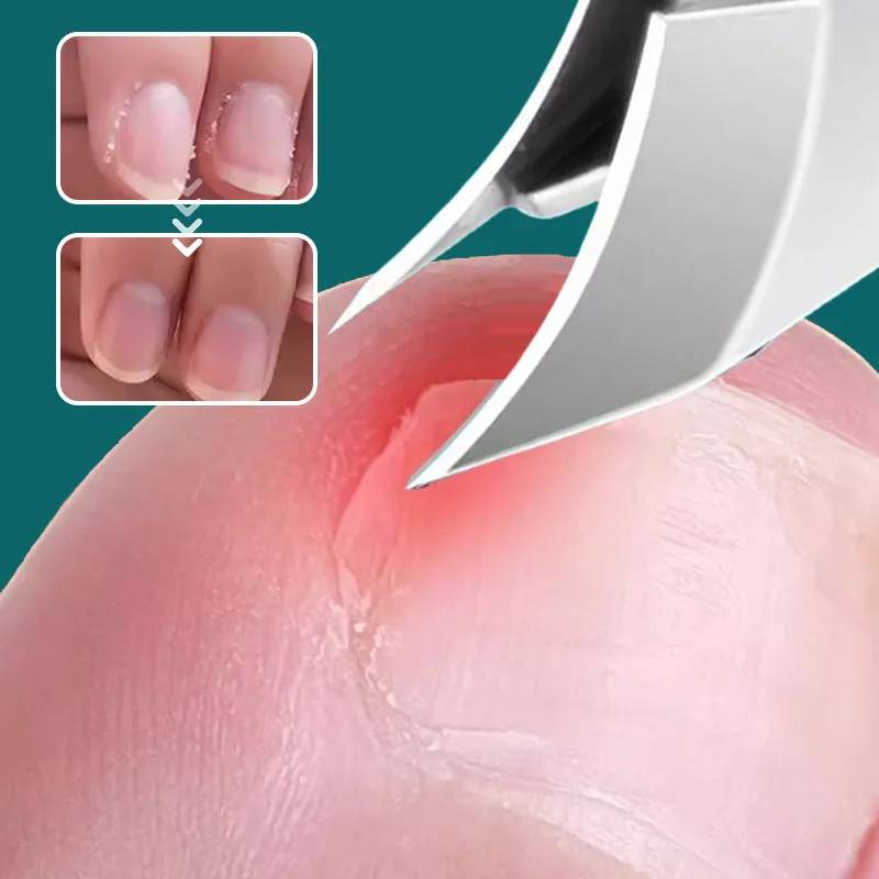 2025 Hot Sale Anti-Splash 25 Slant Edge Nail Clipper 3-Piece Set